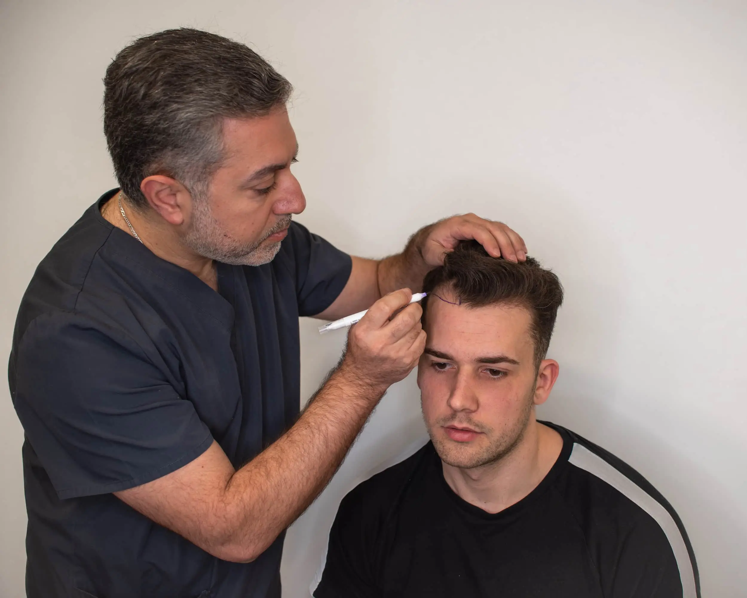Affordable Hair Transplant UK – Top-Rated Clinics